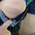 مدرس يبرح تلميذ اعدادي ضربا لمزاحه مع زميله في مدرسة بالزقازيق