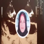 "بالصور"مأساة فتاة بالشرقية تحتاج لزراعة كلى بـ100 ألف جنيه