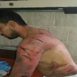 بالصور | بلطجى وصديقه يعذبون ويشعلون النار فى حلاق لظنهما إبلاغه الشرطة عنهما بفاقوس