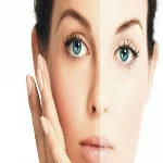 الشتاء ليس السبب الوحيد.. تعرفى على 4 أسباب لجفاف البشرة و5 طرق للعلاج