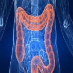 أفضل 4 أطعمة تجنبك الإصابة بسرطان القولون