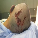 بالصور.. الاعتداء على طفل بألة حادة واصابته فى رأسه بالشرقية