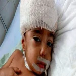 خلافات الضرائر تصيب طفلا بنزيف فى المخ بديرب نجم