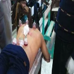 بالصور| جمعية خيرية تستغل مدرسة لإجراء عمليات حجامة فى ابو حماد