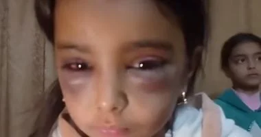 حبس ربة منزل عذبت ابنتي زوجها الطفلتين بالشرقية