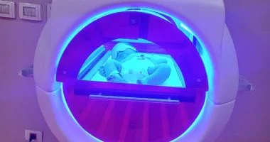 الكبسولة الضوئية تستقبل أول رضيع مصاب بالصفراء بمستشفى العاشر من رمضان الجامعى