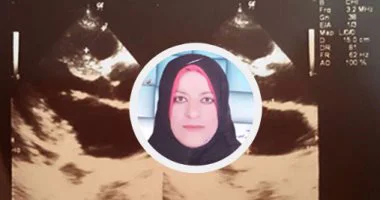 "بالصور"مأساة فتاة بالشرقية تحتاج لزراعة كلى بـ100 ألف جنيه