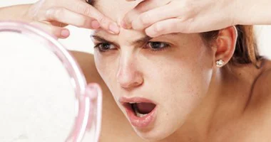 الدمامل الصغيرة خطر على صحة البشرة.. 3 طرق منزلية للعلاج والوقاية