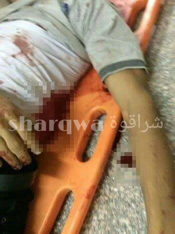 "بالصور" تجمهر الاهالي اعتراضاً على مقتل شاب على يد ضابط شرطه بالخطأ في ابوكبير