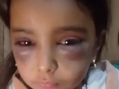 حبس ربة منزل عذبت ابنتي زوجها الطفلتين بالشرقية