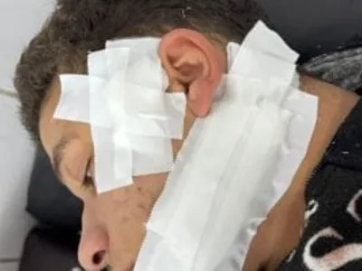 نيابة الزقازيق تأمر بضبط طالب ثانوى طعن زميله بعد لجنة الامتحانات